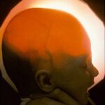 大脑缺失 小脑只有蚕豆大小！美国“无脑畸形”女子创造奇迹