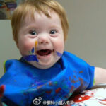 福利院领养儿童患先天梅毒，医生推测生母孕期感染