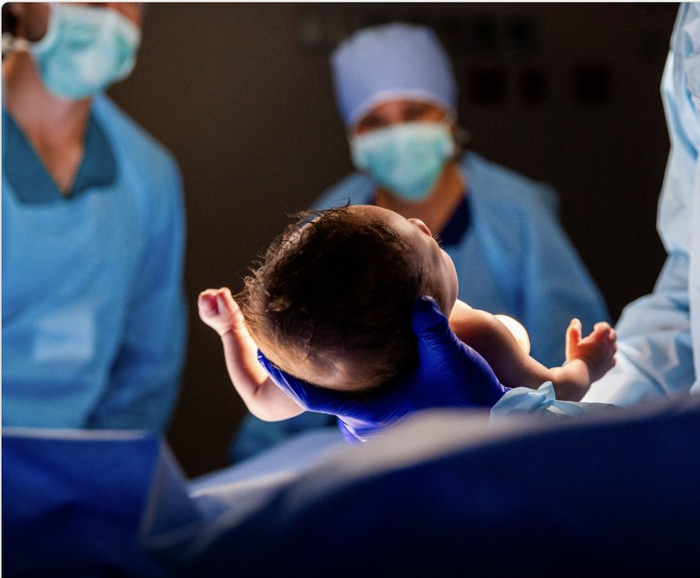 剖腹产分层缝合技术可降低女性长期健康风险