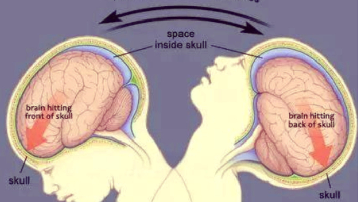 隐形“伤娃习惯”难发现，尤其是这3个，已成许多家长习惯
